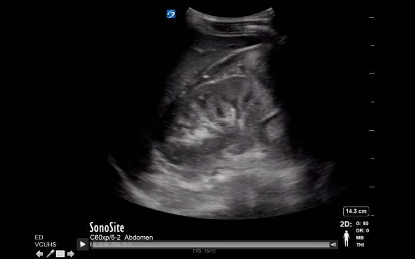 Screen Shot 2016-06-23 at 8.46.35 PM