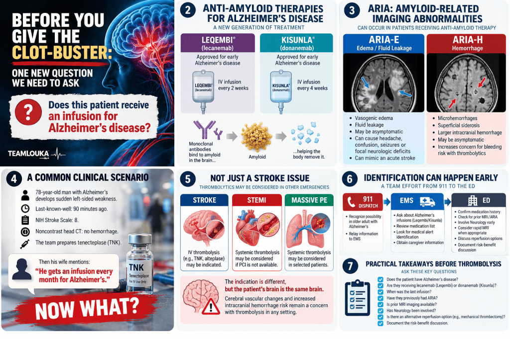 Infographic about considerations for administering thrombolytics in patients with Alzheimer’s disease, featuring details on anti-amyloid therapies and clinical scenarios.