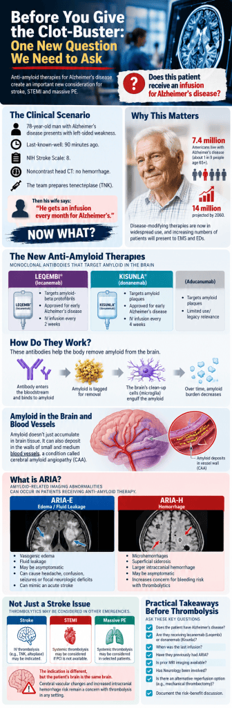 Infographic discussing considerations for administering clot-busting drugs in Alzheimer's patients, featuring information on new anti-amyloid therapies, their mechanisms, and associated risks.